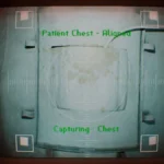 Mastering the Silent Hill: Townfall X-Ray Puzzle: A Comprehensive Guide